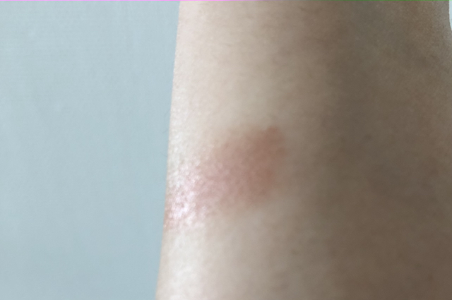 ETVOSアイバームレビュー